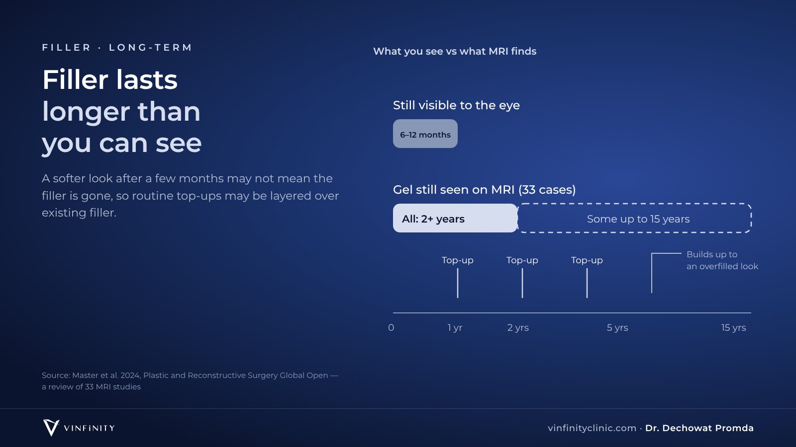 Filler appears to last about 6–12 months to the eye, but MRI detects the gel for at least 2 years and in some cases up to 15 years